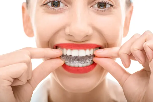 invisalign vs smile direct club renton wa