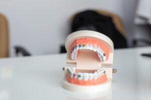 Braces for Your Smile: How They Improve More Than Just Your Looks