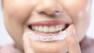 Future of Orthodontics: The Game-Changing Benefits of Invisalign